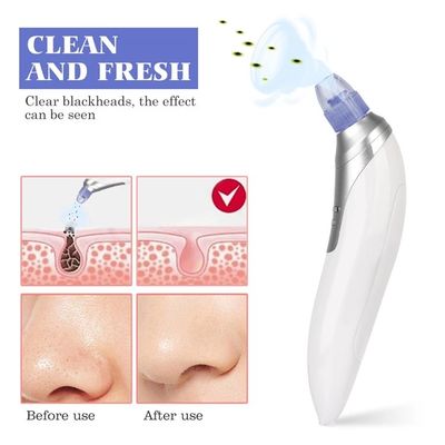White Color Vacuum Microcrystalline Blackhead Remover For Teenager